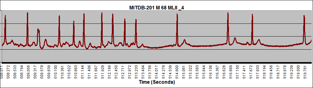 MITDB-201_MLII_Male_68Yrs-Old_472-531.997